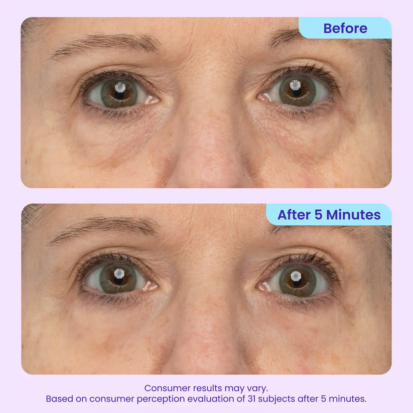 ✨ Look 10 Years Younger In One Swipe — 2026’s Hottest Eye Gel ⏳ Last Day