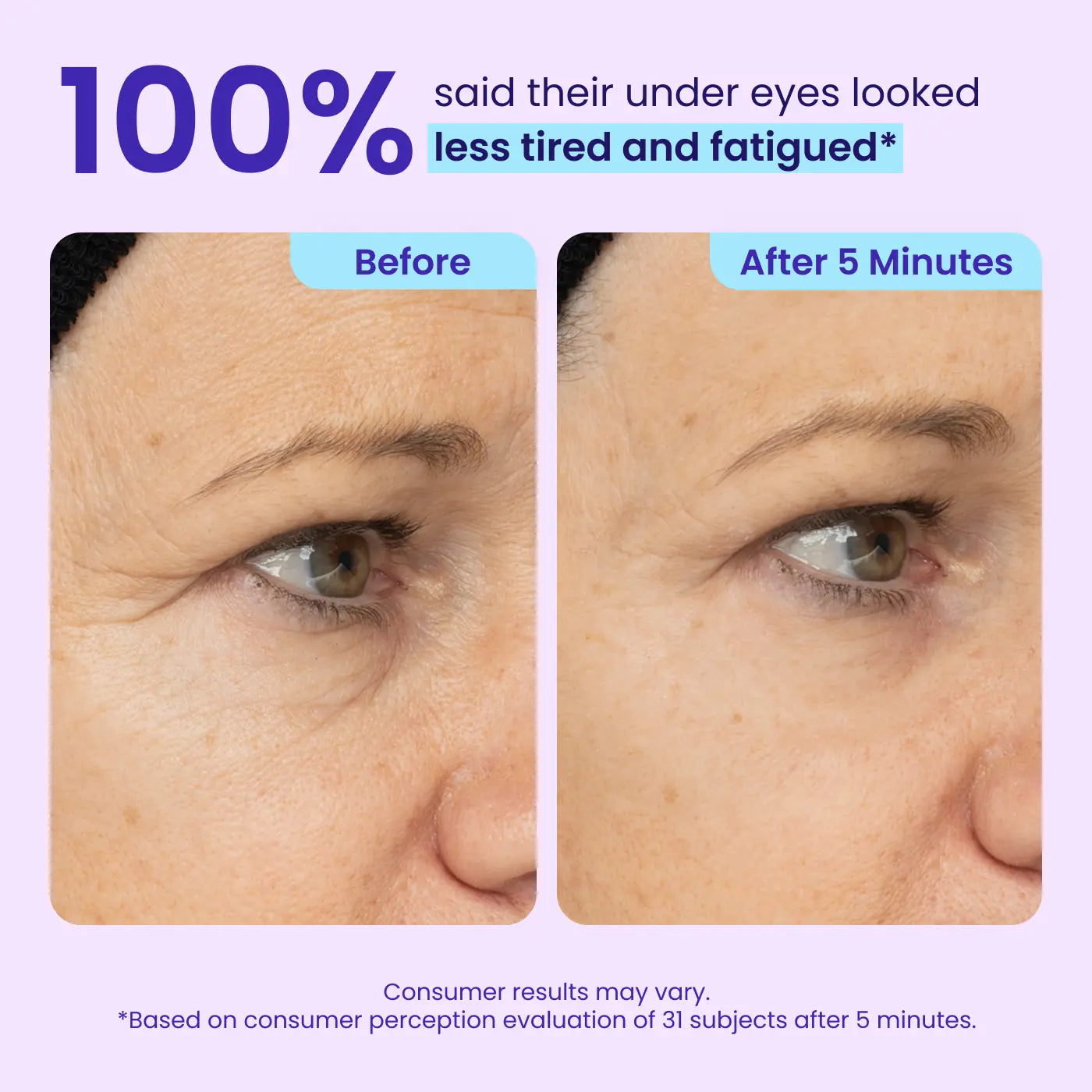✨ Look 10 Years Younger In One Swipe — 2026’s Hottest Eye Gel ⏳ Last Day