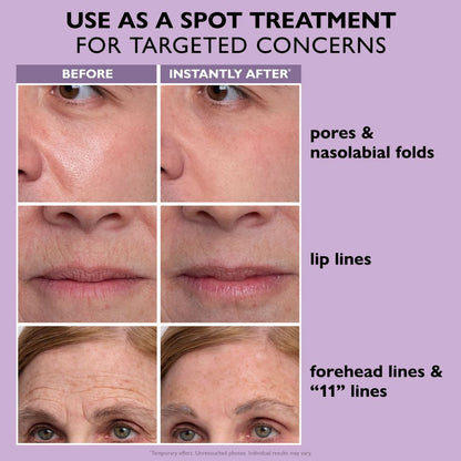 🌸[Official Store] 🌸 Instant Ageless Repair Serum | Visibly Tighter in 60 seconds . Lasts All Day.