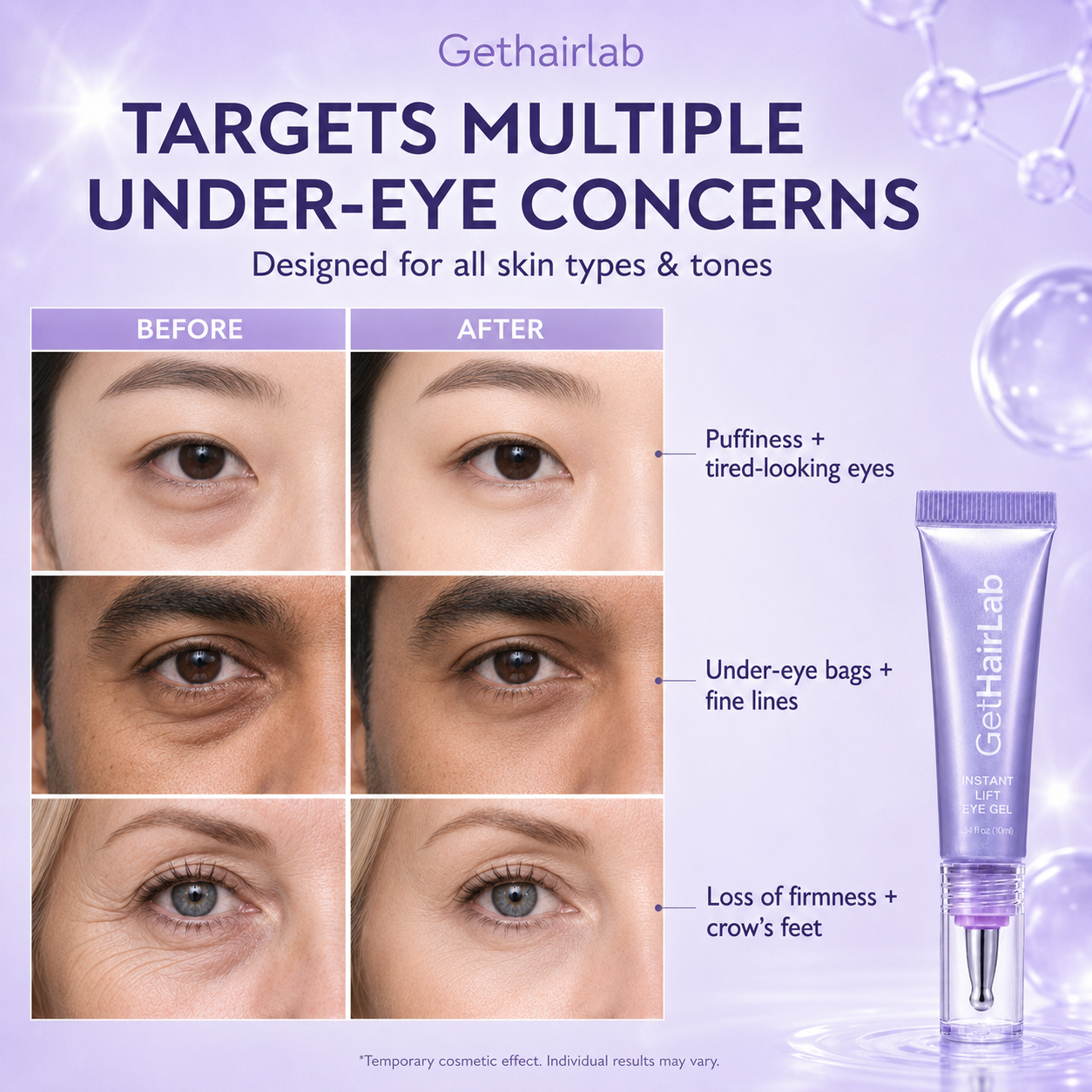 ✨ Look 10 Years Younger In One Swipe — 2026’s Hottest Eye Gel ⏳ Last Day