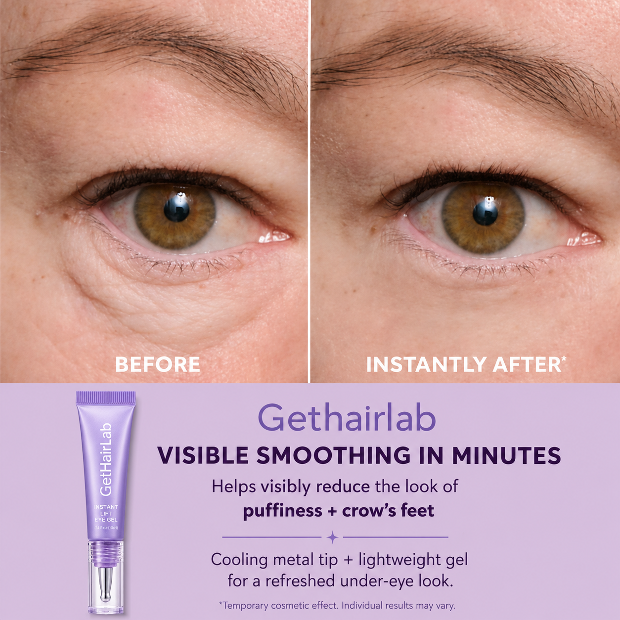 ✨ Look 10 Years Younger In One Swipe — 2026’s Hottest Eye Gel ⏳ Last Day