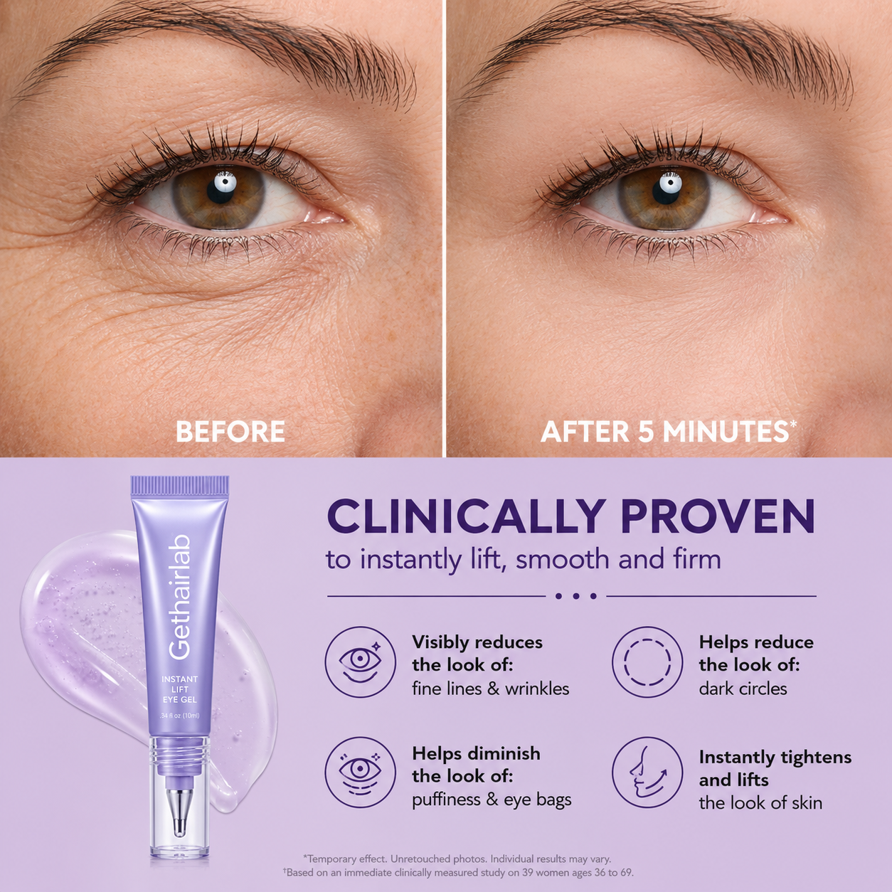 ✨ Look 10 Years Younger In One Swipe — 2026’s Hottest Eye Gel ⏳ Last Day