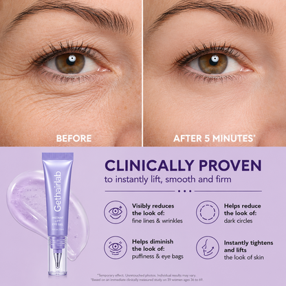 ✨ Look 10 Years Younger In One Swipe — 2026’s Hottest Eye Gel ⏳ Last Day