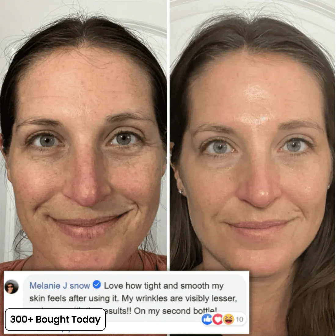 PDRN Pink Collagen Volume Multi Balm