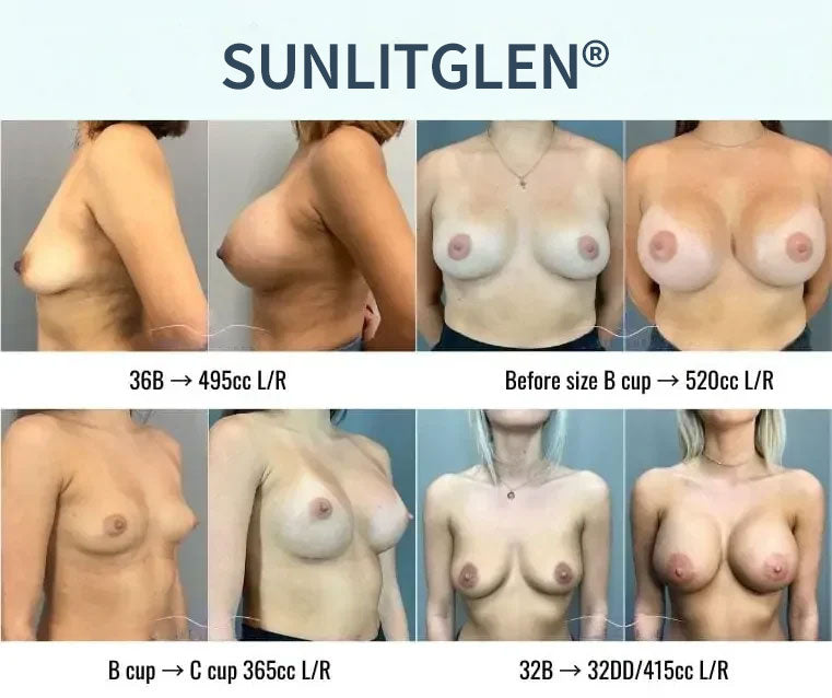 Sunlitglen® Targeted Breast Enhancement Advanced Patch