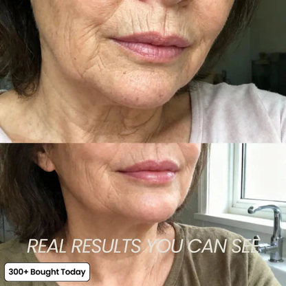 PDRN Pink Collagen Volume Multi Balm