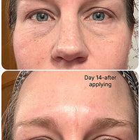 Hydrating instant lift to the eyes (Image 2)